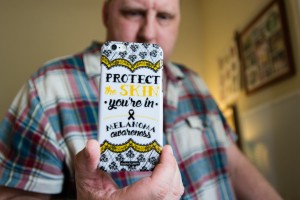Matt Fairchild, 46, holds a cell phone cover he found online.  Fairchild became an advocate for melanoma awareness since being diagnosed with the cancer.  (Heidi de Marco/KHN)