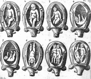 Shakespeare's Twins 19 L0016294 8 representations of the foetus in the womb.
