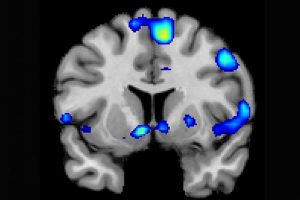 This is Your Brain on God: Spiritual Experiences Activate Brain Reward Circuits 12 braingod01
