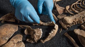 The Archaeology of Disease Documented in Skeletons