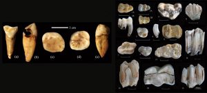 The Archaeology of Disease Documented in Skeletons