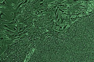 Closing in on a Breakthrough: Blood-Forming Stem Cells 16 Closing in on a Breakthrough: Blood-Forming Stem Cells