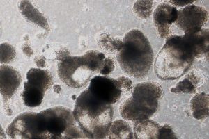 Closing in on a Breakthrough: Blood-Forming Stem Cells 17 Closing in on a Breakthrough: Blood-Forming Stem Cells