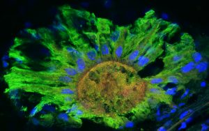 Seeing without Eyes - the Unexpected World of Nonvisual Photoreception