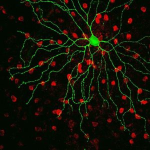 Seeing without Eyes - the Unexpected World of Nonvisual Photoreception