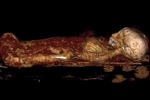 Clues to Ancient Past with Scanning of Baby Mummy Skull 35 092517-05-Mummy