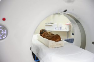 Clues to Ancient Past with Scanning of Baby Mummy Skull