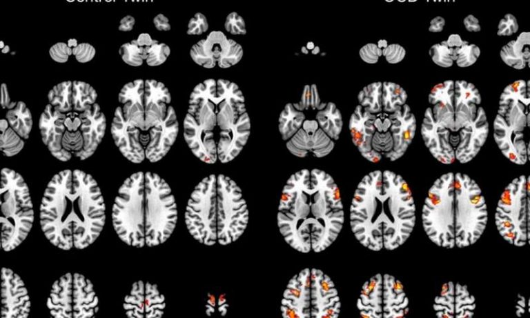 102017-05-Mental-Illness-Medicine