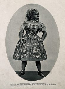 Julia Pastrana: The Story of the "Bearded Lady" from Mexico