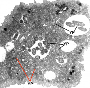 Plague Bacteria Hiding in Soil and Water Microbes, Waiting to Emerge 25 Plague Bacteria Hiding in Soil and Water Microbes, Waiting to Emerge