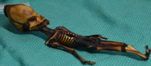 Extracting DNA from Human Remains for Archaeology and History: An Ethical Dilemma 18 Extracting DNA from Human Remains for Archaeology and History: An Ethical Dilemma