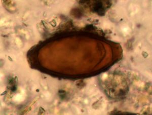 Why the Romans Weren't Quite as Clean as You Might Have Thought 19 Why the Romans Weren't Quite as Clean as You Might Have Thought