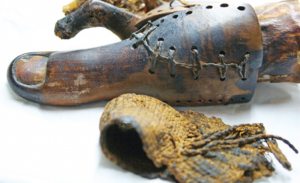 Severed Limbs and Wooden Feet: How the Ancients Invented Prosthetics 18 Severed Limbs and Wooden Feet: How the Ancients Invented Prosthetics
