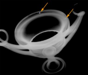 Shaking an Ancient Cup and Living to Tell the Tale