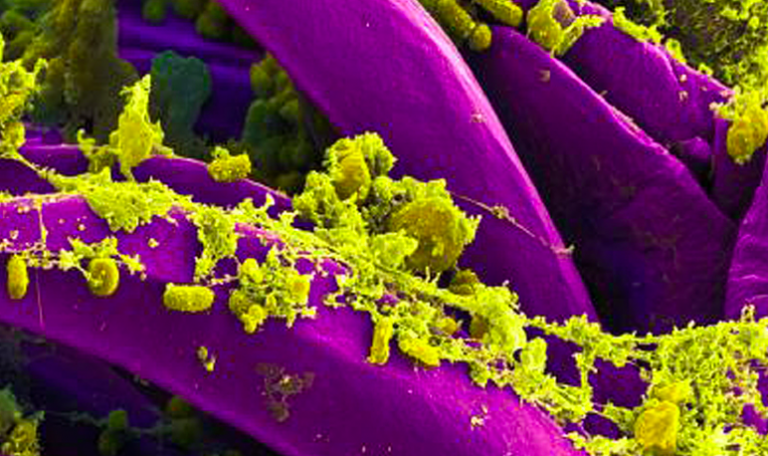 050818-20-Yersinia-Pestis-Plague-Medieval-Middle-Ages-History