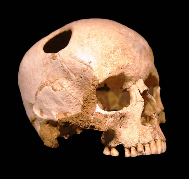 A Skull Bone Discovered in Greece May Alter the Story of Human Prehistory -  The New York Times