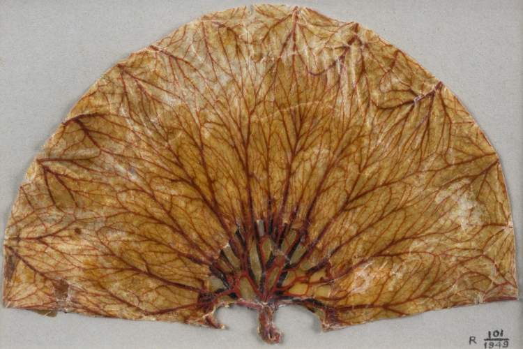 Getting Under the Skin: A Brief History of Human Dissection Brewminate ...