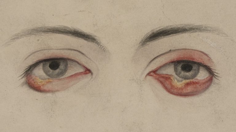 111618-121-History-Disease-Prostitution-Victorian-Medicine