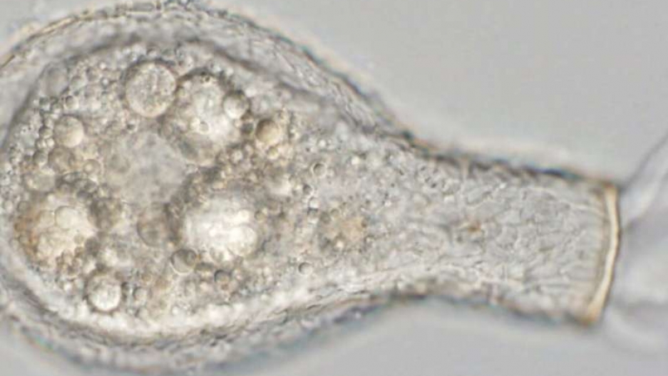 'Micro Snails' Help Unlock Details of Ancient Earth's Biological Evolution