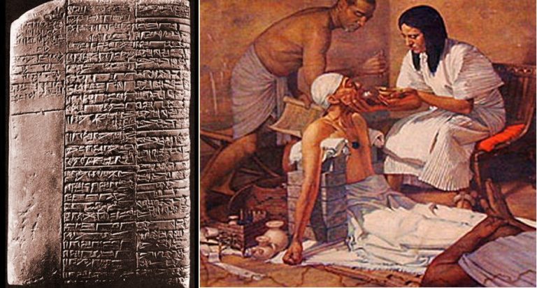 052619-16-History-Ancient-Mecicine-Surgery-Mesopotamia