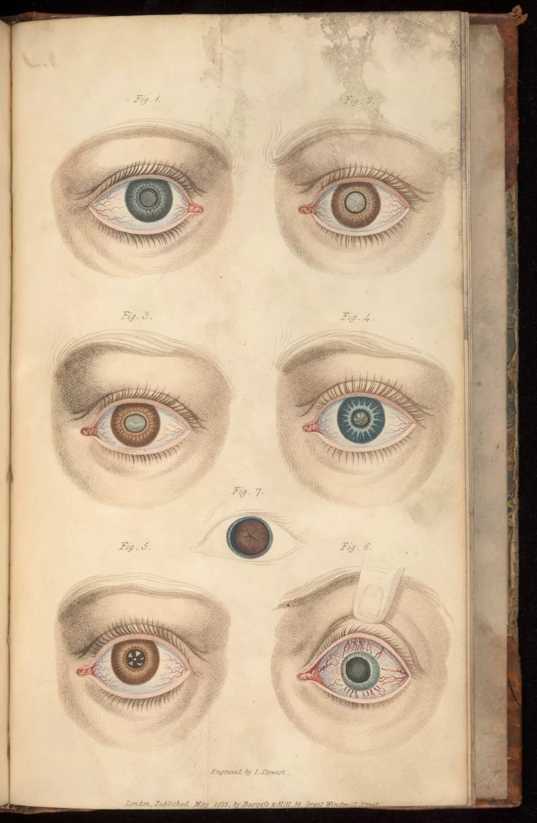 Printing the Body: Anatomical Illustration in the Early Modern Period ...