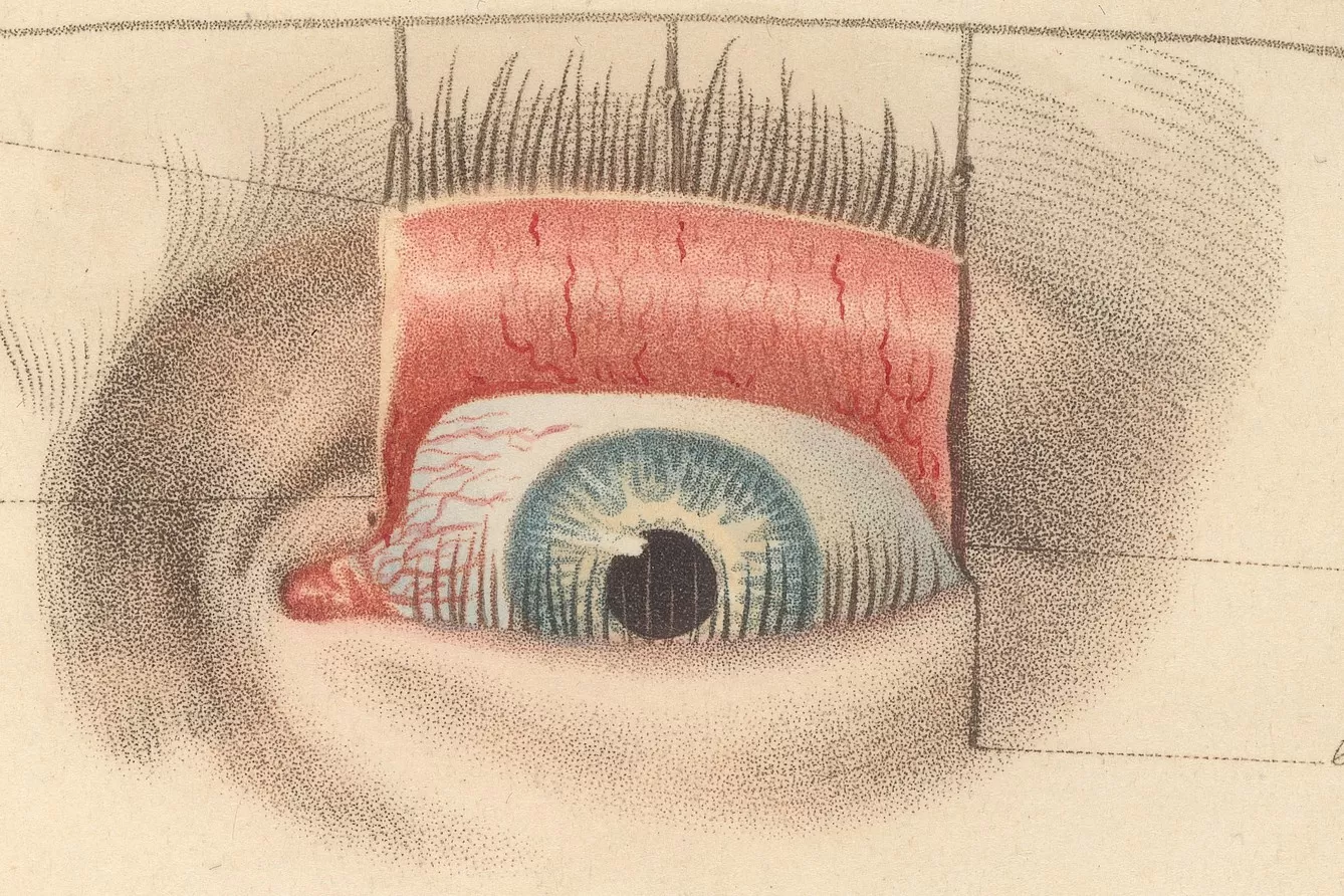 Printing the Body: Anatomical Illustration in the Early Modern Period ...