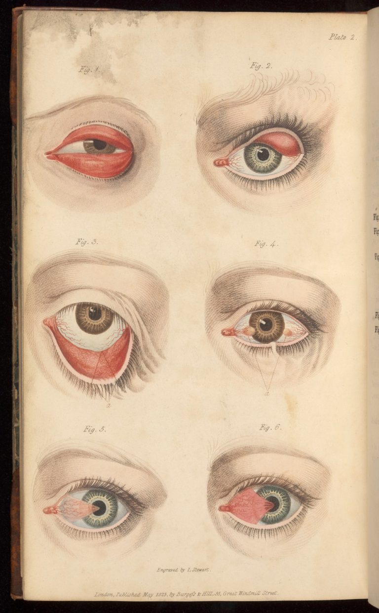 Printing the Body: Anatomical Illustration in the Early Modern Period ...