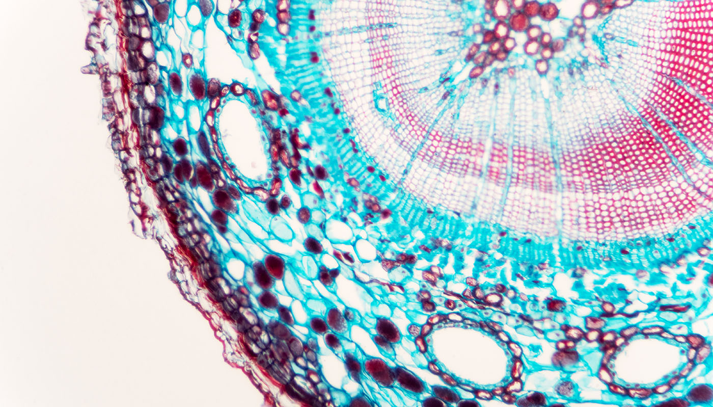 Microscopic view of stem of wood dicotyledon