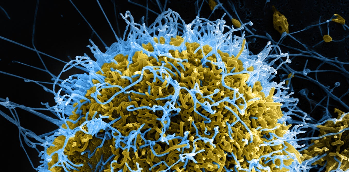 020320-02-Coronavirus-Health-Care-Disease