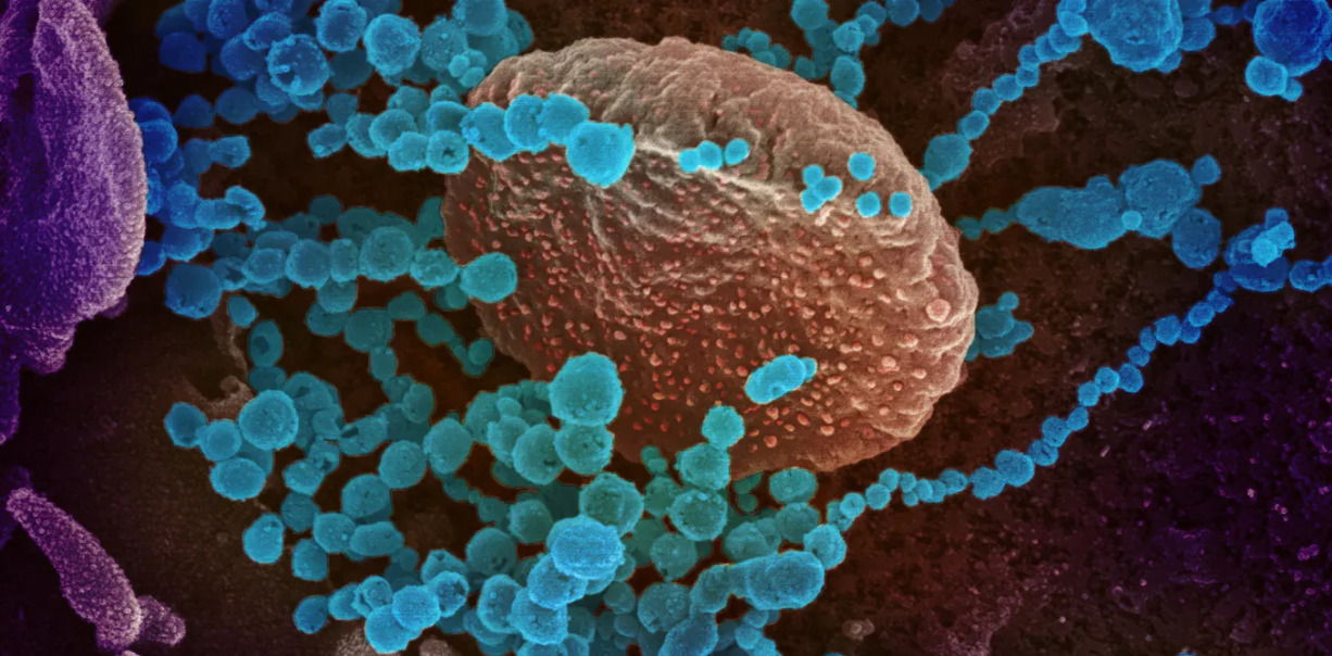 A New Type of Vaccine Using RNA Could Help Defeat COVID-19 1 032620-38-Coronavirus