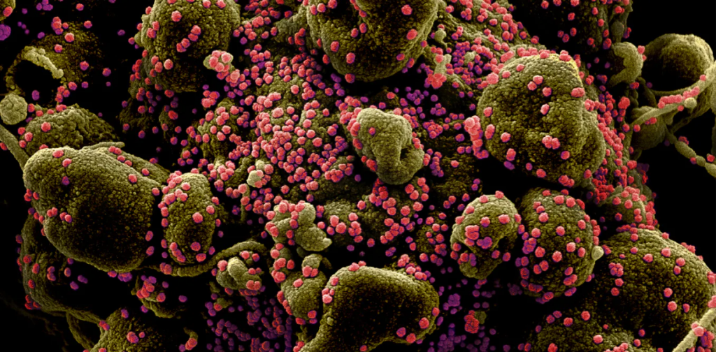 What COVID-19 Does to Your Body That Makes It So Deadly