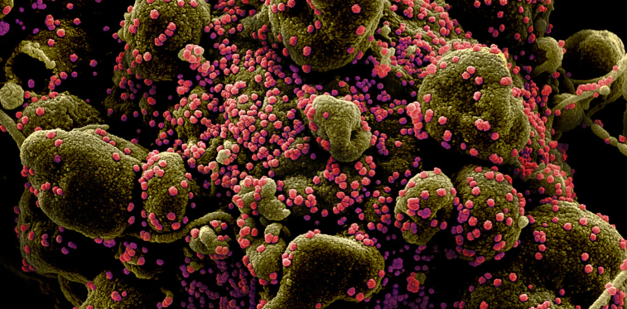 040220-56-Coronavirus