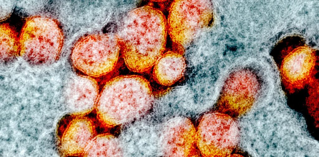 What We Do and Don't Know about COVID-19's Infectivity and Viral Load