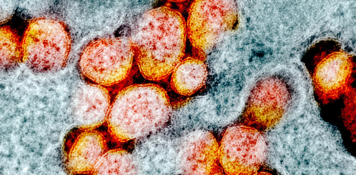 041420-01-Coronavirus-COVID