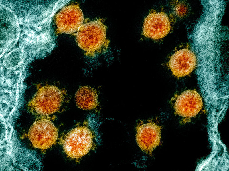 062720-06-Coronavirus-COVID