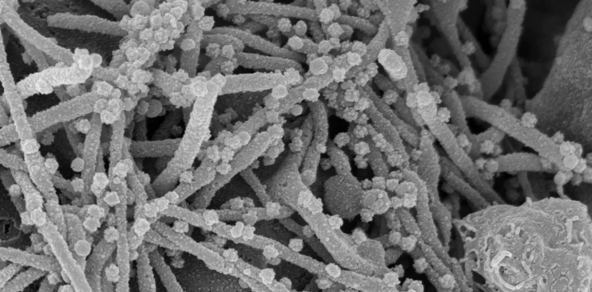 063020-04-Coronavirus-COVID