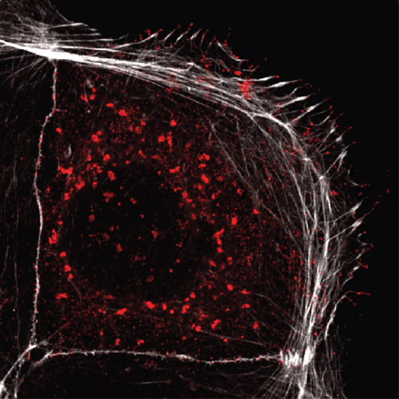 Coronavirus and Cancer Hijack the Same Parts in Human Cells to Spread
