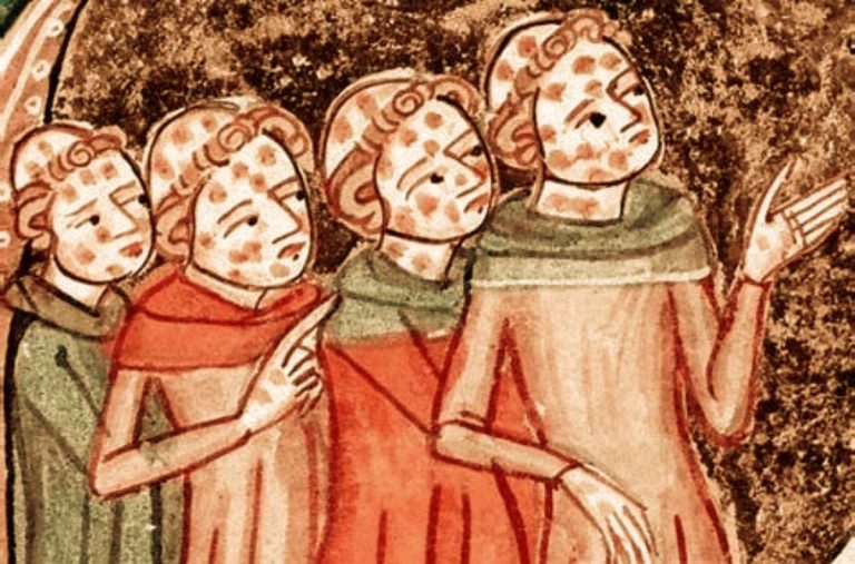 072120-37-History-Medieval-Disease-Leprosy