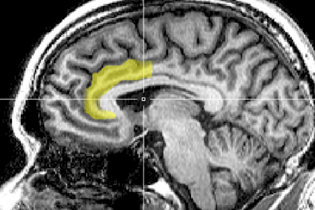 The Psychology of Election Denial in the Face of Overwhelming Evidence 3 The Psychology of Election Denial in the Face of Overwhelming Evidence