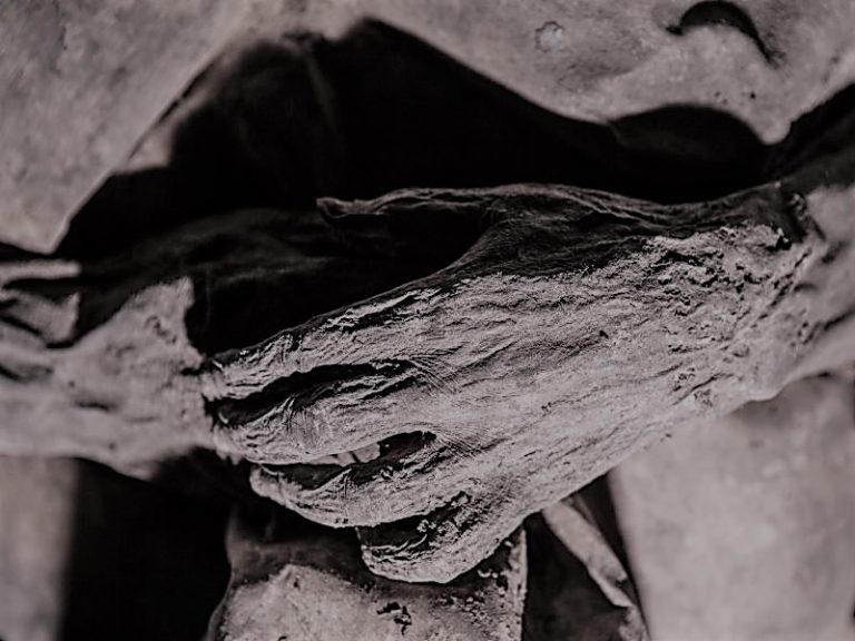 122021-01-History-Disease