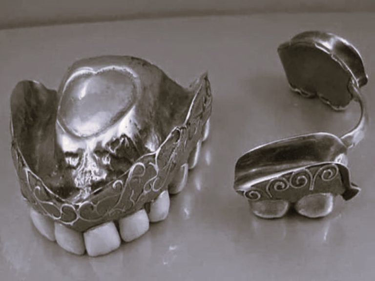 TrueHistoryFalseTeeth-WillBail02