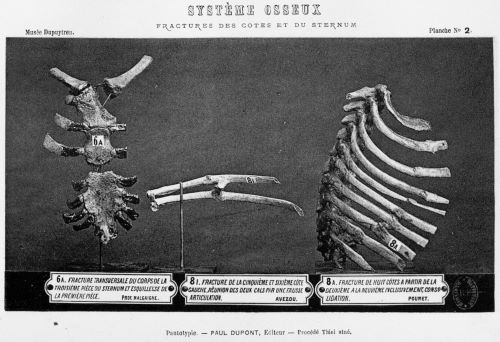 Displaying the Dead: The Musée Dupuytren Catalogue 22 Displaying the Dead: The Musée Dupuytren Catalogue