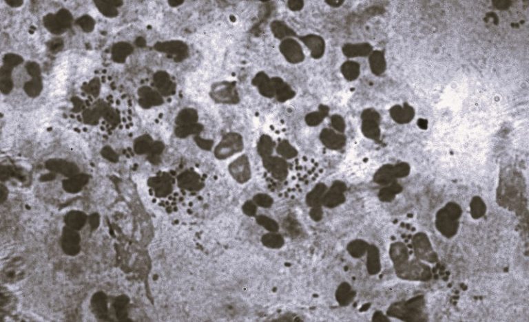 030423-21-History-Disease