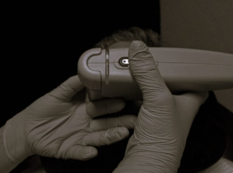 FaceliftRecovery-HannahGilbert02