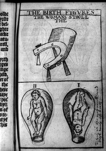 Clockwise from top: Woman’s stool (birthing chair); fetus in uterus, head down, marked “This is the naturall [sic] and best way of birth”