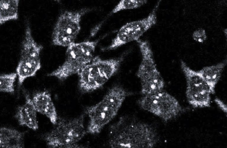 ReceptorInflammation-HannahGilbert02