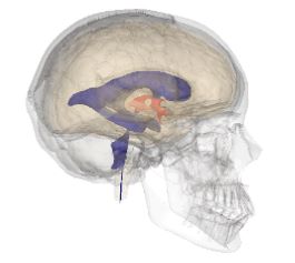 Science and Invention in Da Vinci's Renaissance Brain 12 Science and Invention in Da Vinci's Renaissance Brain