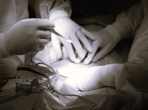 FibroidTreatment-HannahGilbert02