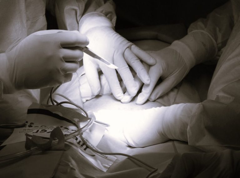 FibroidTreatment-HannahGilbert02