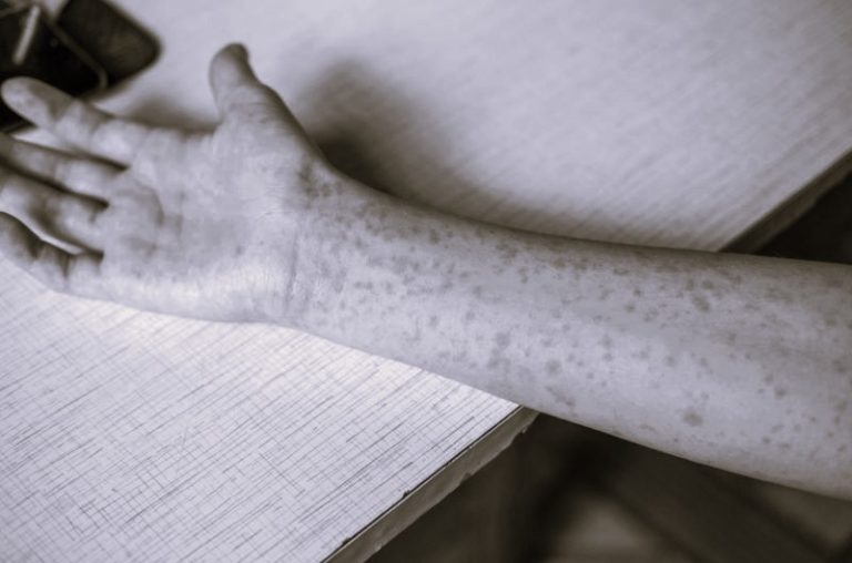 062225-26-Disease-Medicine